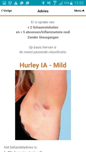 Hidradenitis Suppurativa App Screenshot 3