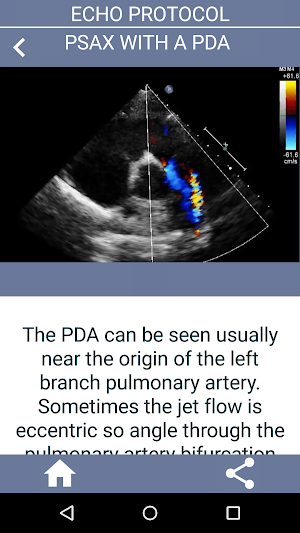 LEARN THE FULL TTE ECHO ULTRASOUND PROTOCOL DEMO Screenshot 3
