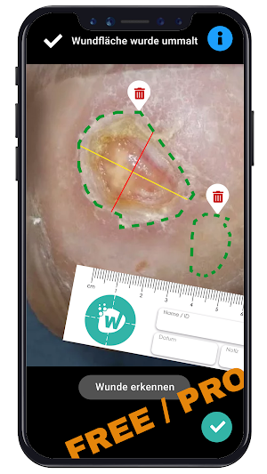 WUNDERA® Wundmanagement Screenshot 2