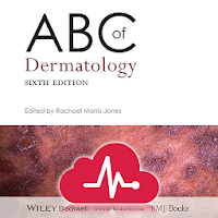 ABC Dermatology for Nurses and Medical Students