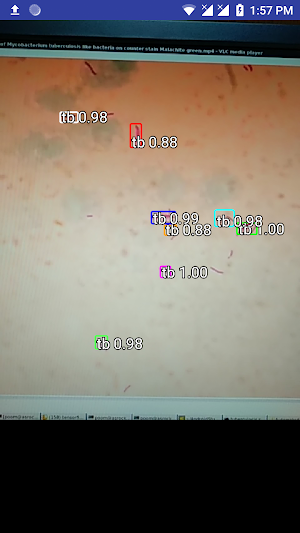 Tuberculosis Screenshot 0