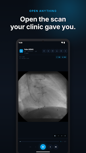 Radix DICOM Viewer: CT & MRI Screenshot 0