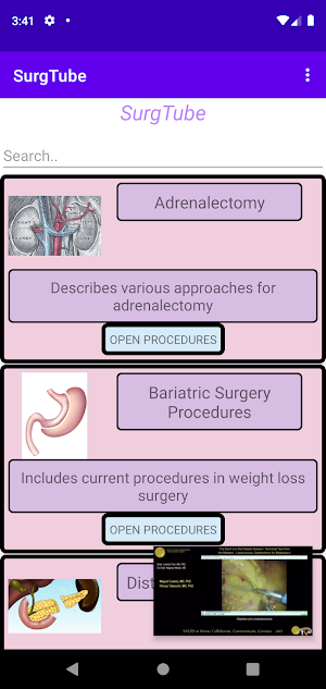 SurgTube Screenshot 0
