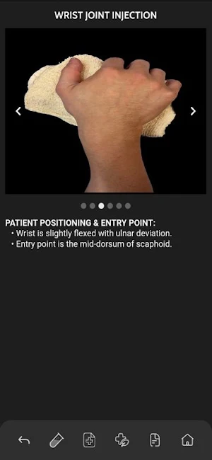 VBS RadGuide: MSK Injections Screenshot 1