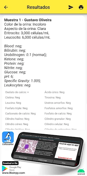 Urine AI Strip reader Screenshot 3