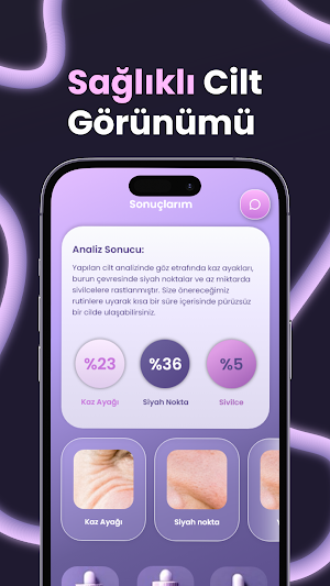 Epiderm AI: Cilt Bakım Analizi Screenshot 3