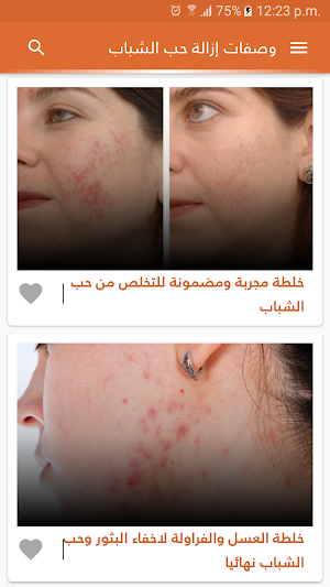 وصفات لازالة حب الشباب بدون نت Screenshot 2