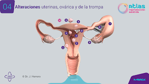 Atlas RA - MERCK Screenshot 3