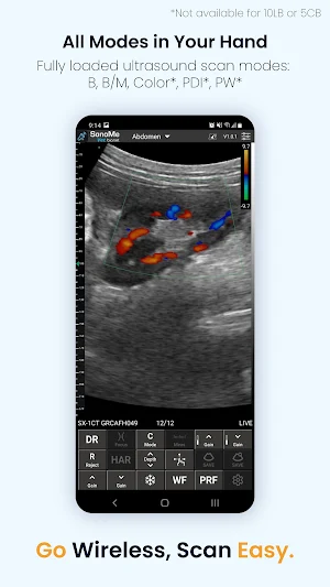 SonoMe VET Screenshot 3