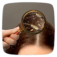 Head Lice Treatment Guide