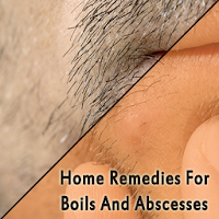 Home Remedies For Boils And Ab