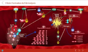 iHemostasis Screenshot 3