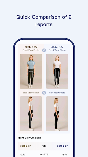PoseAlign - AI Posture Scanner Screenshot 2