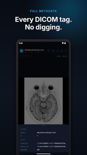 Radix DICOM Viewer: CT & MRI Screenshot 3