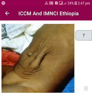 ICCM and IMNCI 2021 Ethiopia Screenshot 2