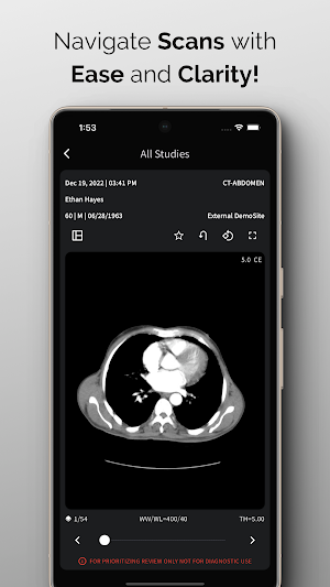 NeuroView Screenshot 0