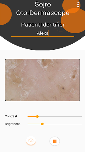 Oto-Dermascope Screenshot 3
