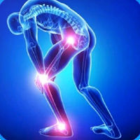 Rheumatoid Arthritis Treatment