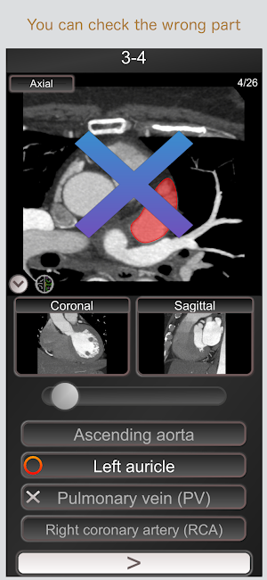 CT PassQuiz Heart / sectional anatomy / MRI Screenshot 1