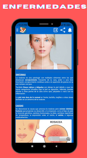 Enfermedades de la Piel en Español Screenshot 2