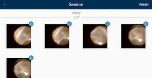 hearScope Screenshot 3