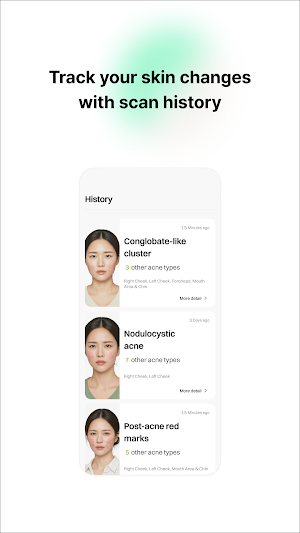 Acnecare AI Screenshot 3