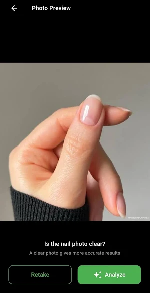 NailCheck AI Screenshot 3