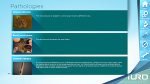 iURO Kidney Pro Screenshot 2