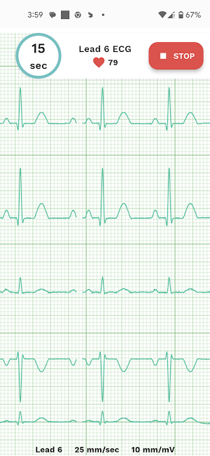 Teton Health Screenshot 1