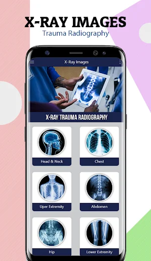 X-Ray Trauma Radiography Screenshot 1