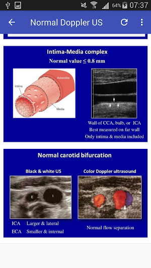 Doppler US Of Carotid arteries Screenshot 2