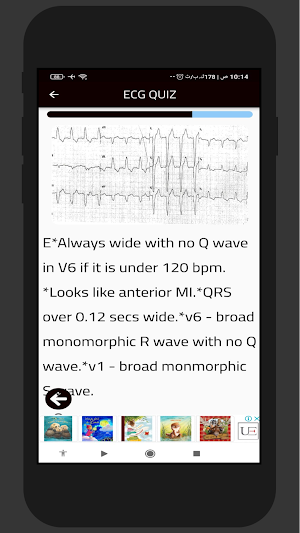 Learn ECG In 15 minutes Screenshot 3