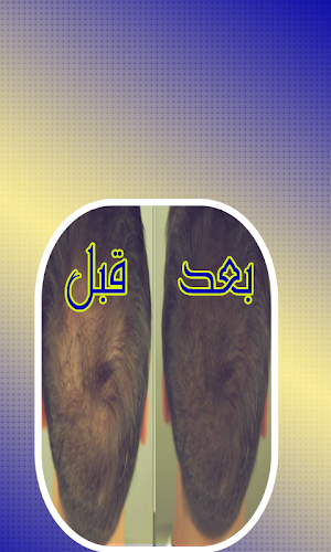 تكثيف و تقوية الشعر Screenshot 0