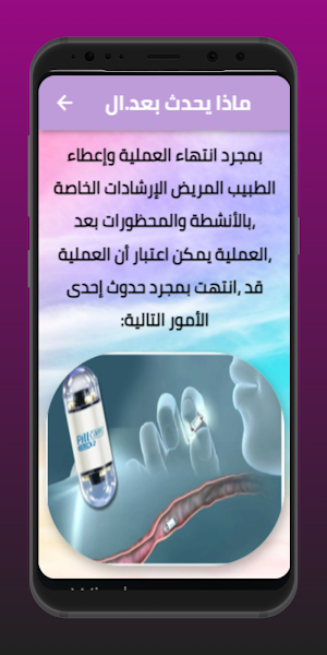 التنظير الكبسولي Screenshot 3