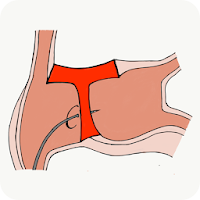 Transeptaid