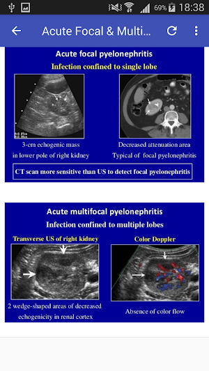 Ultrasound Urinary Tract Screenshot 1