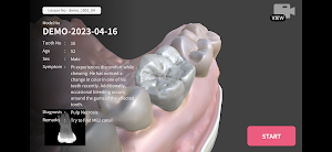 Dental EndoMaster Screenshot 3