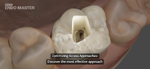 Dental EndoMaster Screenshot 2