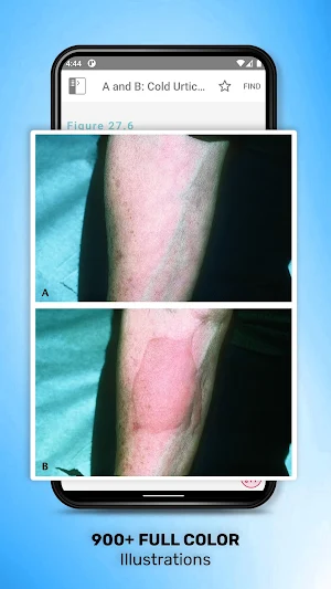 Pediatric Adult Skin Disorders Screenshot 2