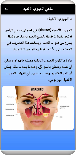 علاج الجيوب الأنفية في المنزل Screenshot 1