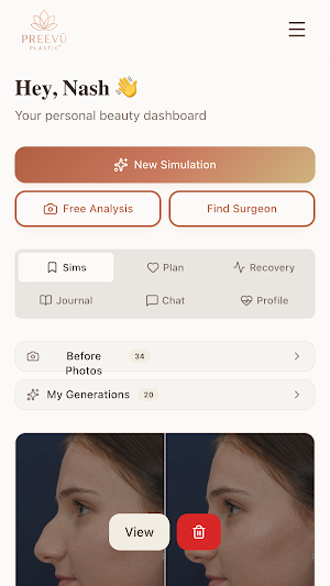PREEVŪ Plastic Screenshot 0