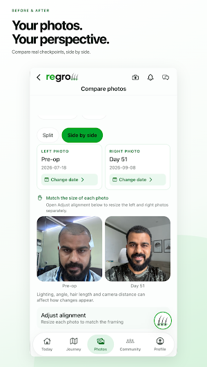 Regrow: Hair Transplant Care Screenshot 1