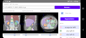 mobyNIfTI Screenshot 1