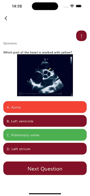 Cardiology Cases: ECG Quiz App Screenshot 2