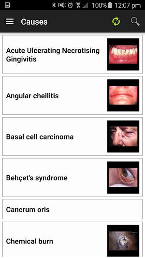 Diagnosis of Oral Ulceration Screenshot 3