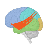 SGH Neuro MO Stroke