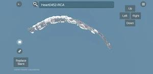 UMN Stents Screenshot 0