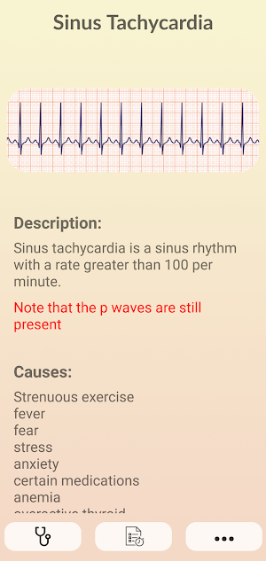 ECG Guide - Master Electrocardiogram Reading Screenshot 1