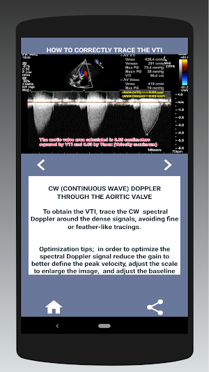 AORTIC STENOSIS PROTOCOL GUIDE Screenshot 3