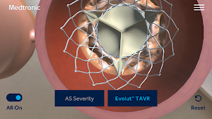 AS TAVR Education Screenshot 3